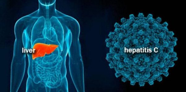 Гепатит С: генотип 1b и его лечение