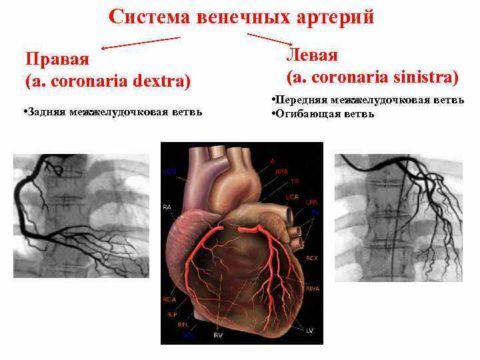 Снимки arteries в разных проекциях при выполнении обследования.