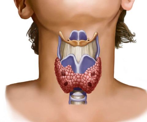 Щитовидная железа отвечает за создание гормонального фона в организме.
