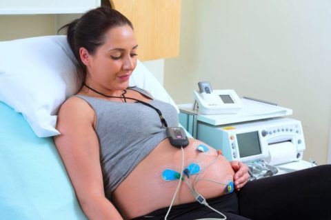 Фиксация датчиков на животе беременной женщины