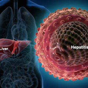 Особенности лечения гепатита С 3 генотипа