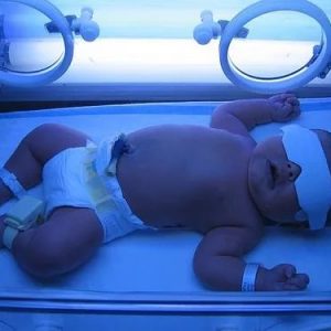 Желтуха у новорожденного: лечение в домашних условиях