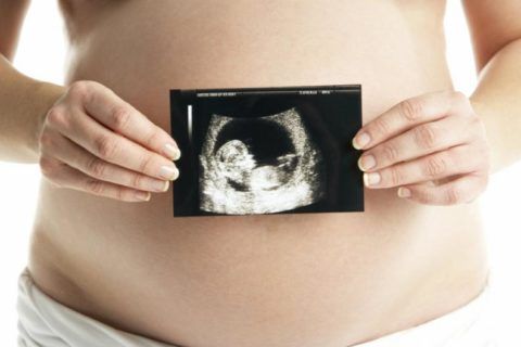 Брадикардия эмбриона