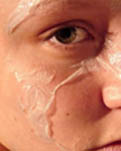 Причины шелушения кожи