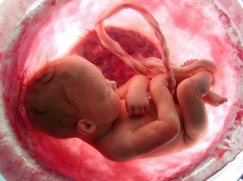 Врожденные пороки сердца развиваются в период 2-8 недели беременности.