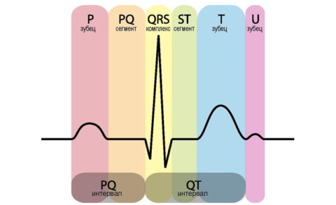 ЭКГ-схема одного сокращения-расслабления сердца при LGL-аномалии