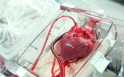 Трансплантация здорового сердца может существенно продлить жизнь