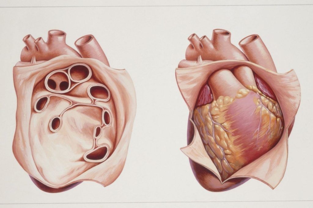 Небольшое количество жидкости обеспечивает плавное движение сердца в перикарде