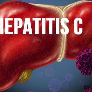 Как проявляется гепатит С у мужчины