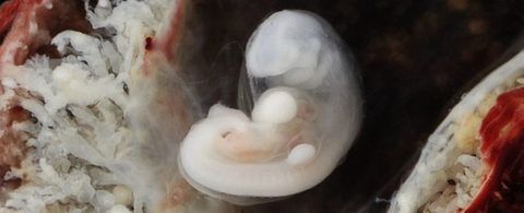 На фото – эмбрион человека на 3 неделе своего развития