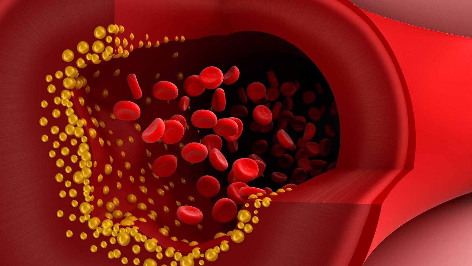 Как правильно и безопасно разжижать кровь в домашних условиях