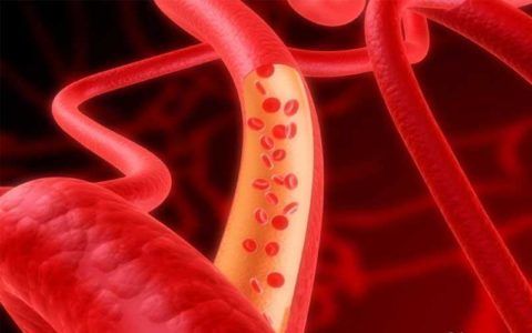 Эффект расширения артерий снижает нагрузку на миокард