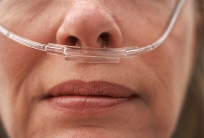 Подача кислорода через носовой катетер