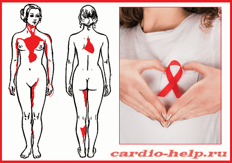 Болевой синдром при патологиях сердца может проявляться и не в кардиальной области