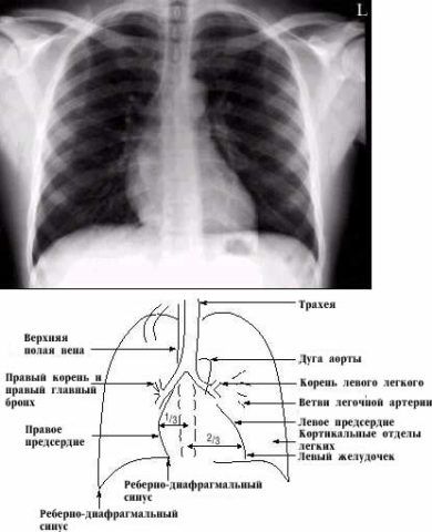 Рентген груди