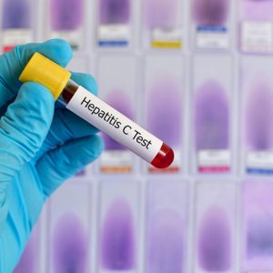 Генотипирование вируса гепатита С