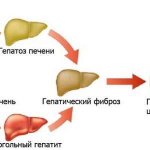 Симптомы и лечение гепатоза печени